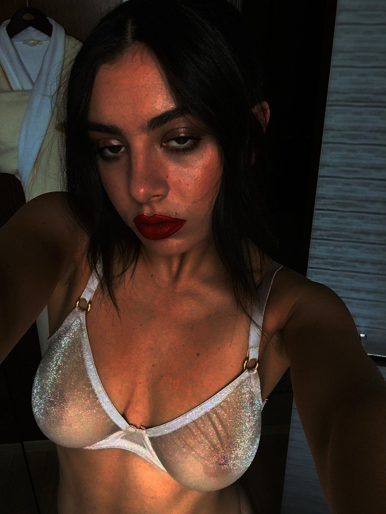 Charli XCX X-Ray (1 Photo)